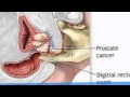 Articles About Prostate Health – Part 4 (Prostate Health) Articles About Prostate Health